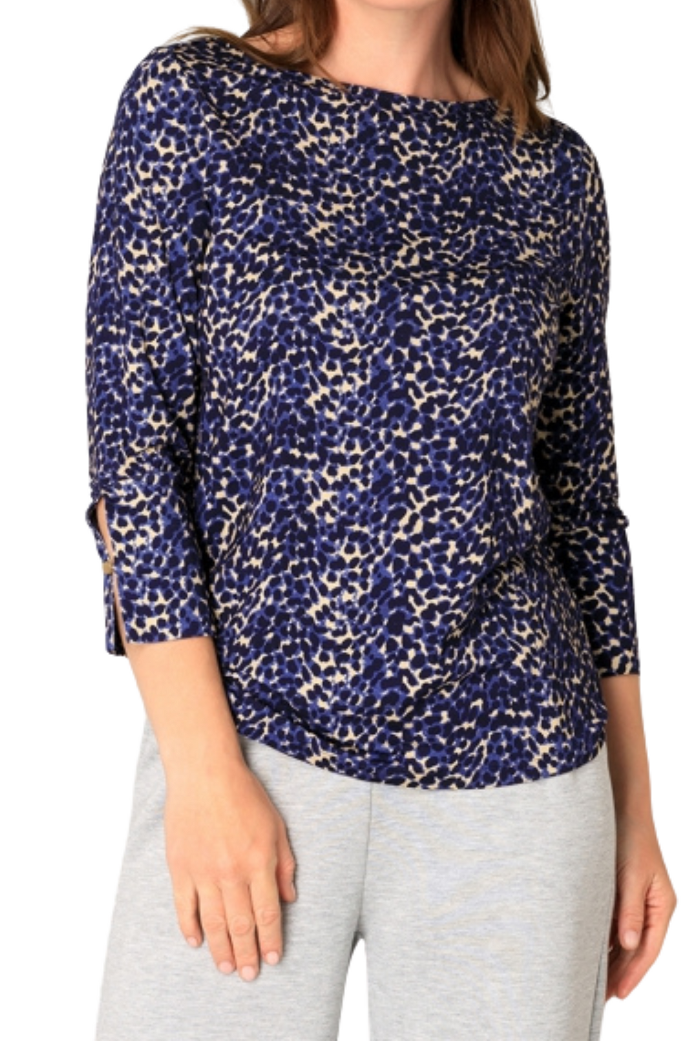 Bryn Top